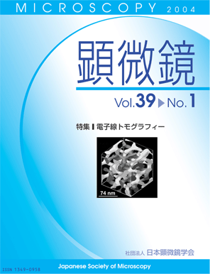 ELECTRON MICROSCOPY \